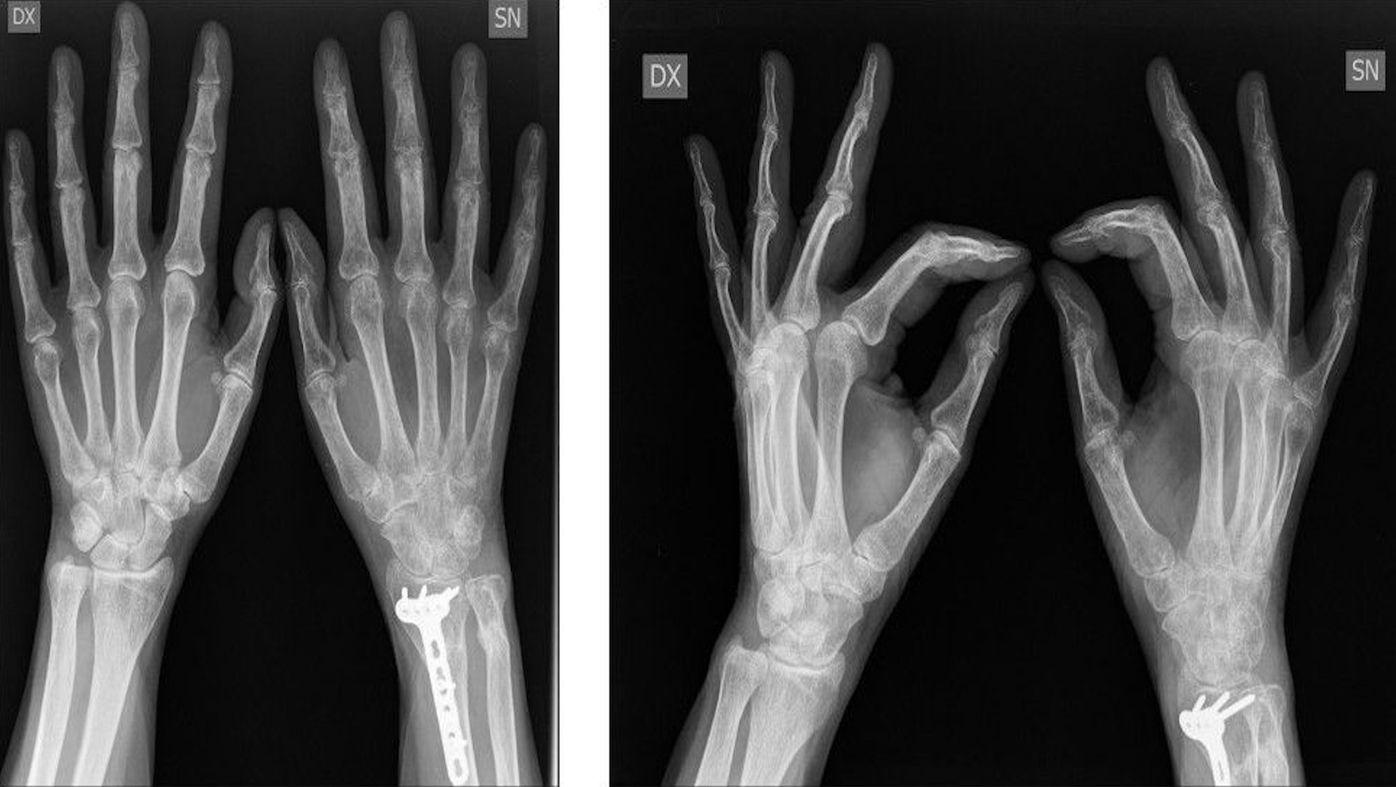 RADIOLOGIA DIGITALE